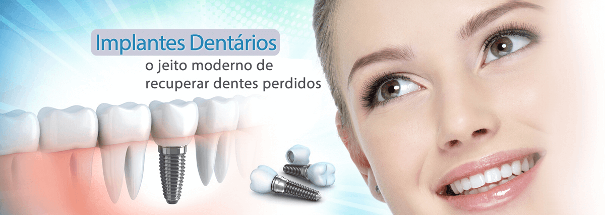 Quanto custa um Implante Dentário em Curitiba