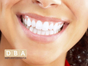 Implantes Dentarios Clínica de Ortodontia em Curitiba